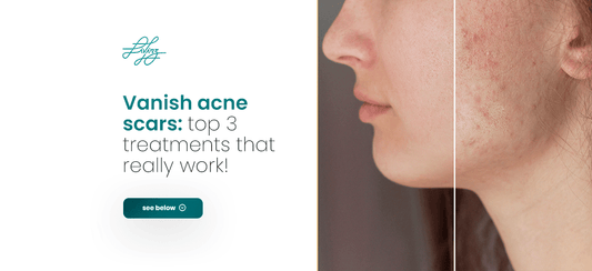 Vanish acne scars: top 3 treatments that really work! - Livinz Medspa