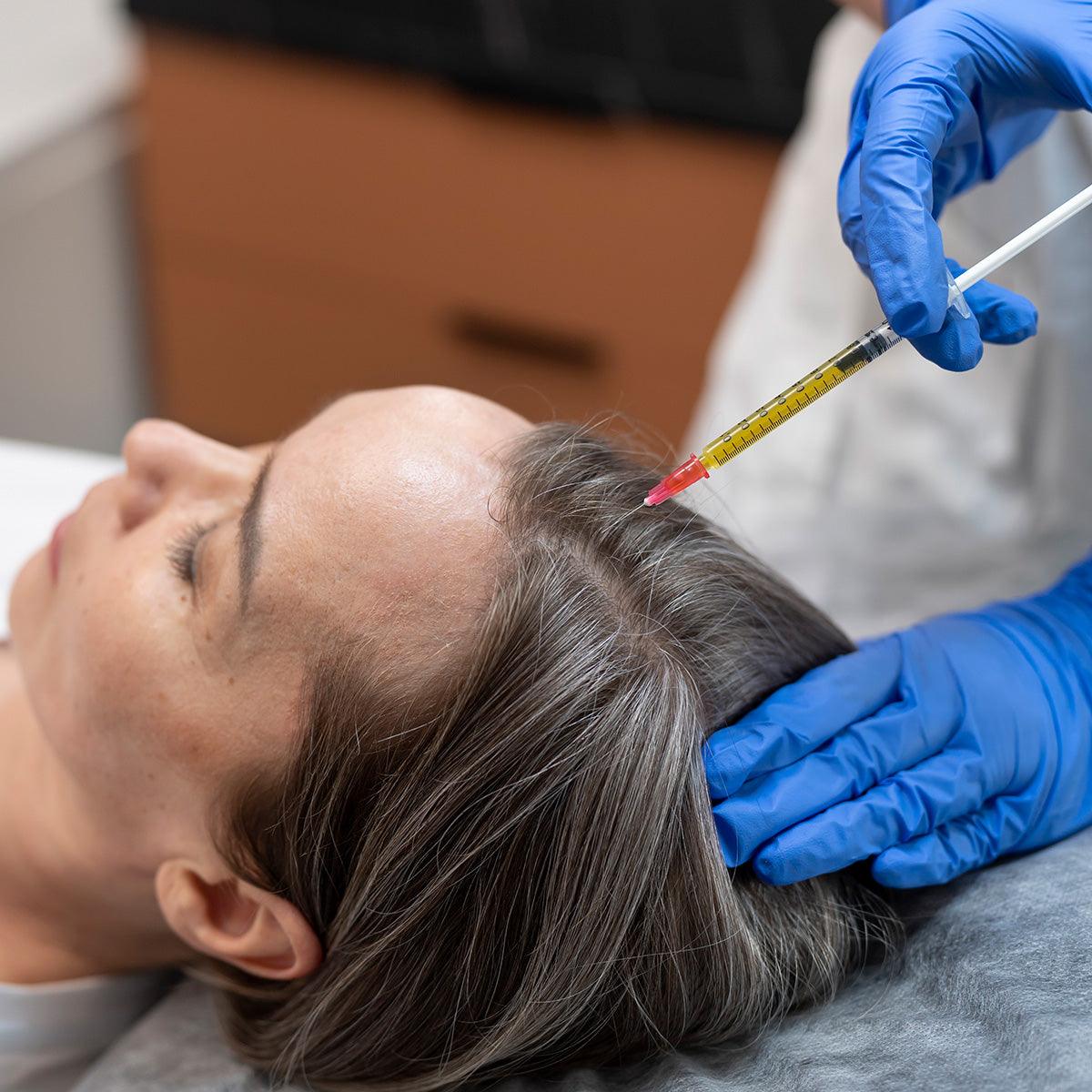 PRP Hair Restoration - Livinz Medspa