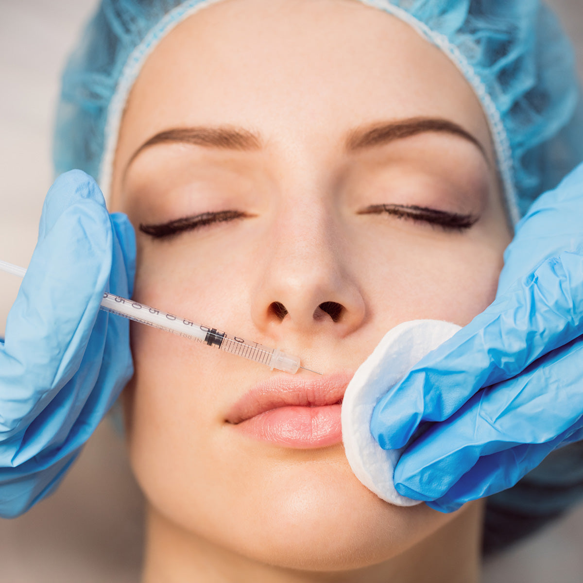 Dermal Filler