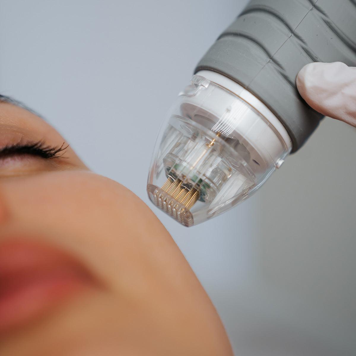 RF Microneedling - Livinz Medspa