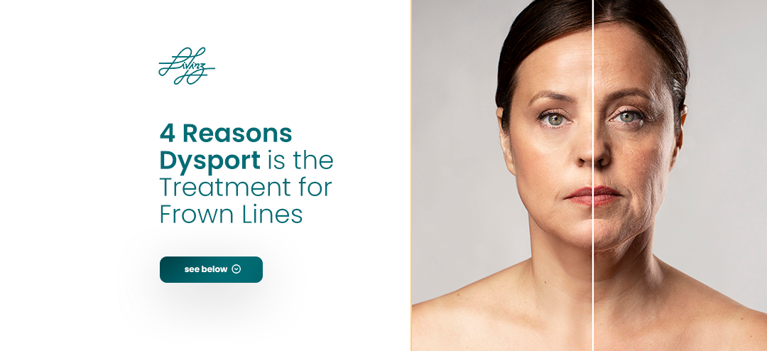 A woman's face, split in two with a vertical line. The left side is smooth, while the right side shows wrinkles, specifically frown lines. Text reads: "4 Reasons Dysport is the Treatment for Frown Lines."