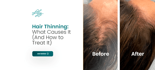 Hair Thinning: What Causes It (And How to Treat It) - Livinz Medspa