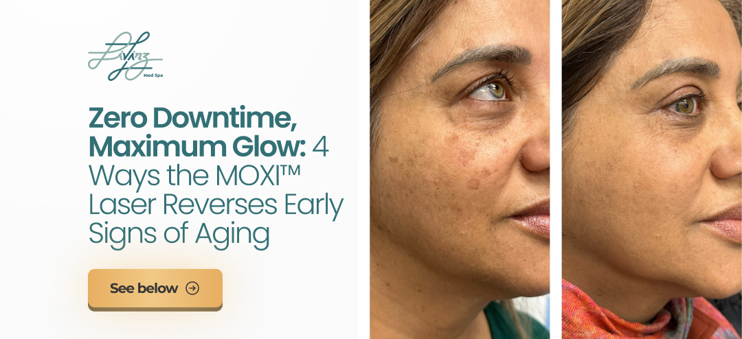 A before-and-after comparison showing the results of a MOXI laser skin treatment.